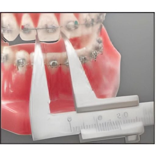 Ortodontik Ölçüm Aletleri